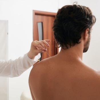 A provider placing an acupuncture needle in a patient's left shoulder.